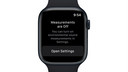 Apple Watch - Noise