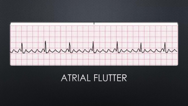 6ACLS Lesson 6 Tachycardia